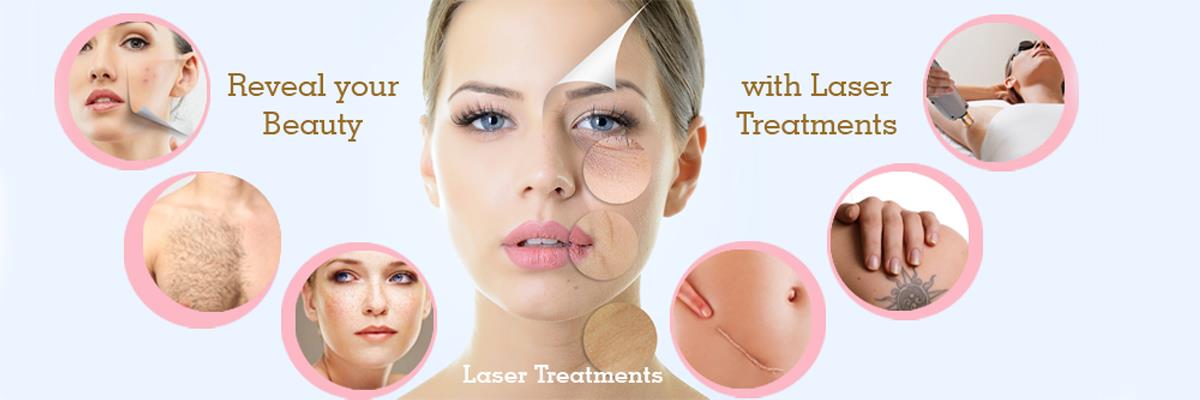 Laser Treatments